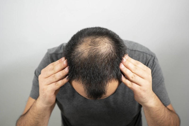 Tìm ra tế bào gốc có thể giúp tái tạo tóc