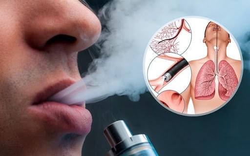 Cảnh báo từ thuốc lá điện tử