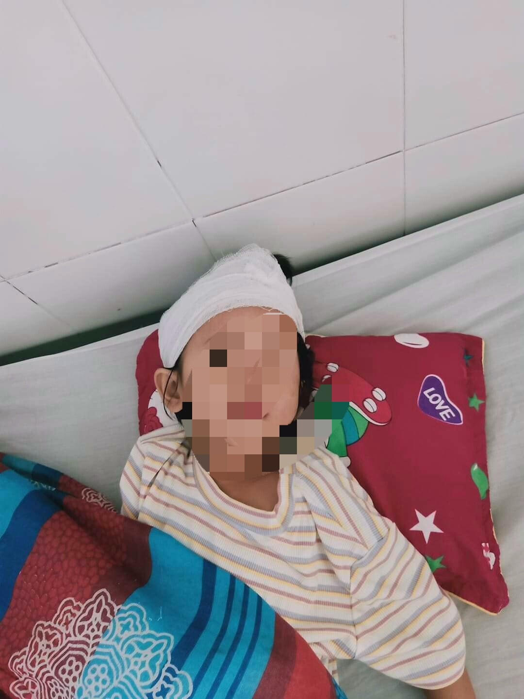 Cháu H.N.V. (4 tuổi) bị chấn thương não, đang được điều trị tích cực.