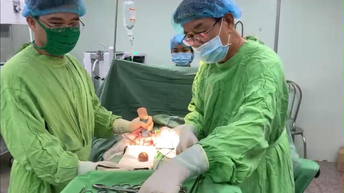 Các bác sĩ của Bệnh viện ĐKTƯ Cần Thơ phẫu thuật lấy viên sỏi khỏi bàng quang bà cụ  