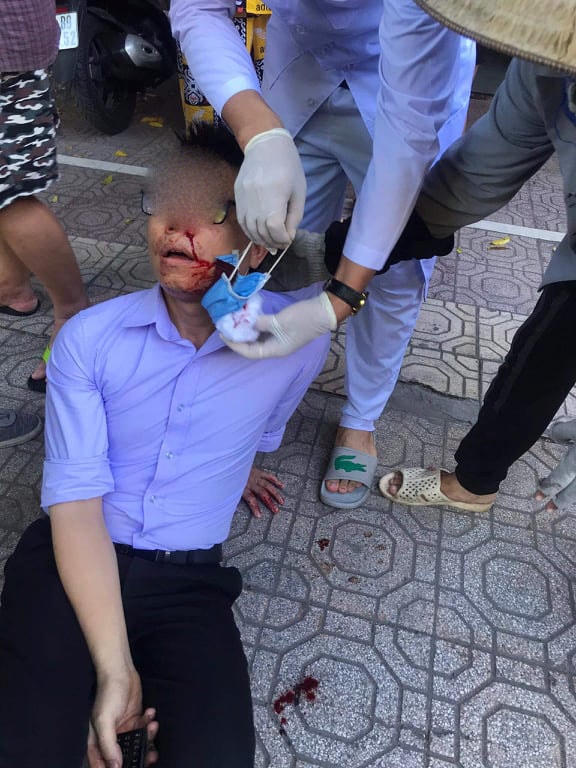 Ông Vũ Văn P. sau khi bị đánh.