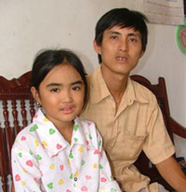 Hình ảnh Diệp và bố 1 năm sau ca ghép gan đặc biệt. Ảnh: Nguyễn Quốc Phòng.