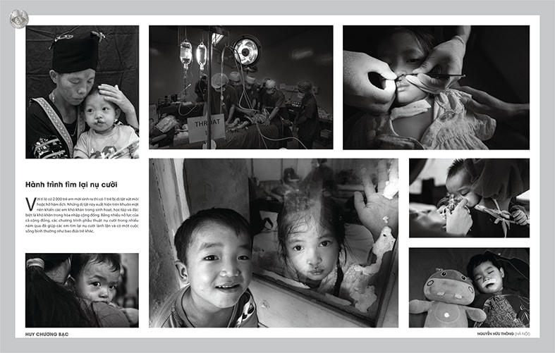 Bộ ảnh "Hành trình tìm lại nụ cười" giành Huy chương Bạc.