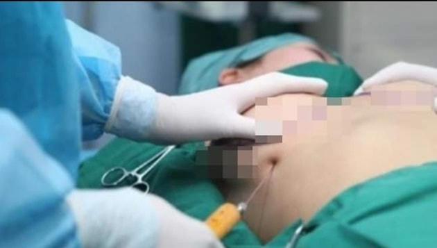 Nhiều khách hàng bị "moi túi" trước những chiêu trò thổi giá dịch vụ thẩm mỹ. Ảnh minh họa.