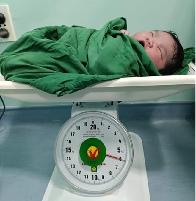 Cháu bé vừa được sinh đã nặng gần 6kg.