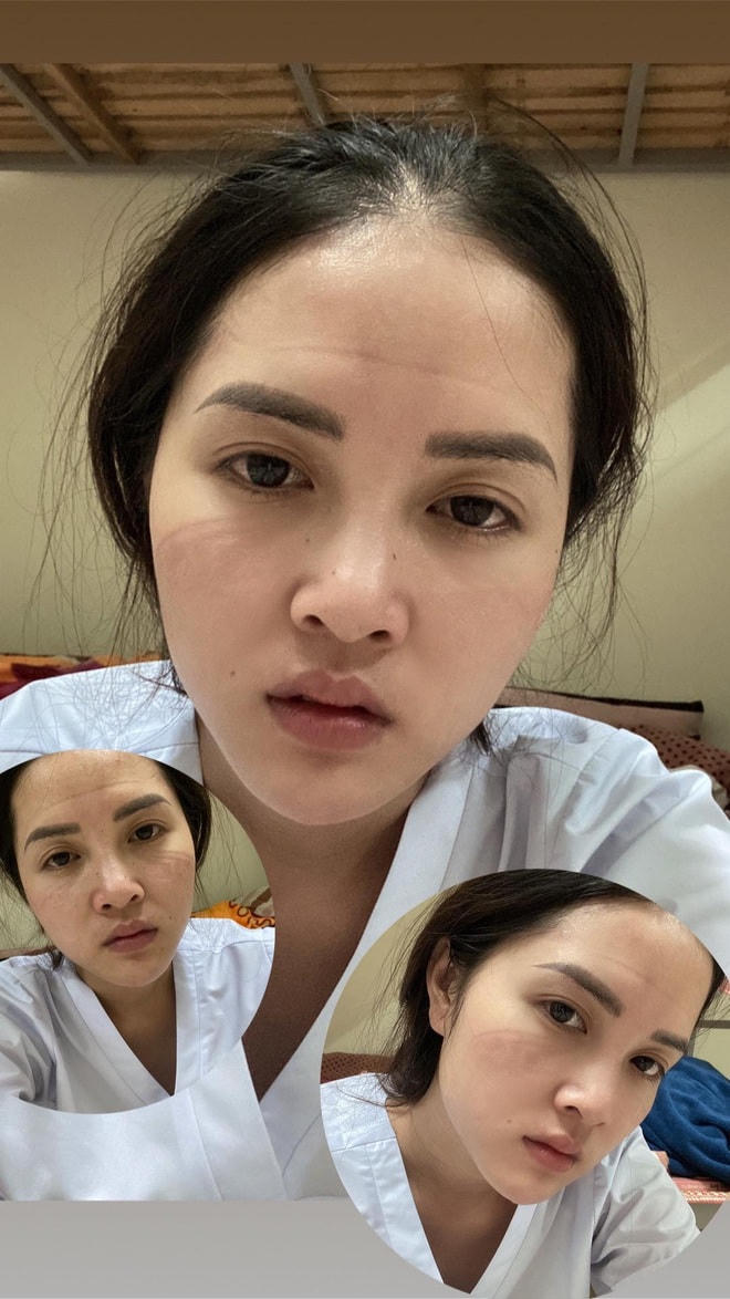 Vết hằn khẩu trang trên mặt của Hạnh khiến nhiều người không khỏi xúc động.  