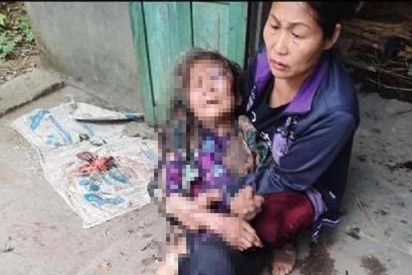 Nạn nhân được người nhà phát hiện kịp thời đưa đi cấp cứu đã hồi tỉnh.