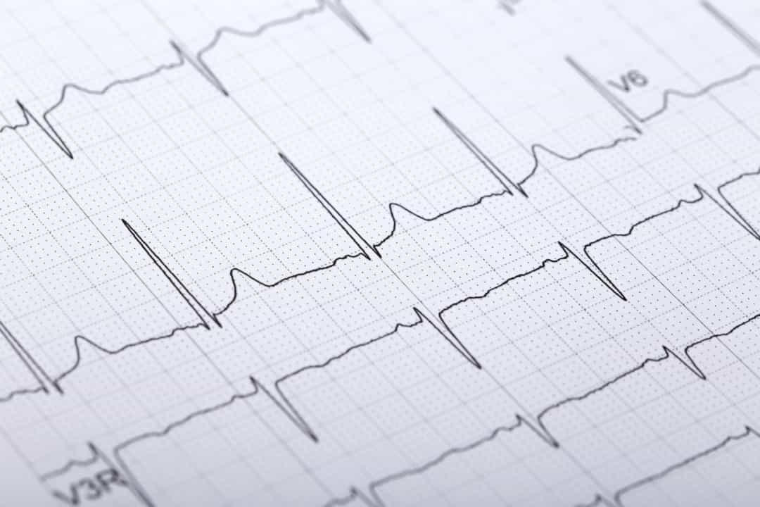 Những rủi ro sức khỏe lớn nhất đối với nam giới