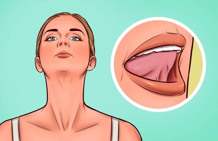 7 bài tập giúp thoát khỏi ‘cổ gà tây’ một cách tự nhiên