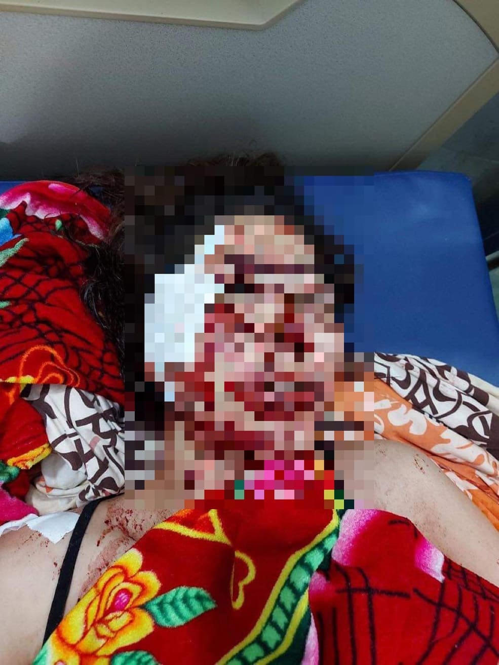 Trong khi đó, mẹ của em A. cũng bị nam thanh niên đâm nhiều nhát vào vùng mặt.