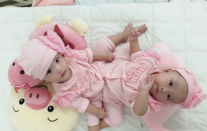 Hai bé Trúc Nhi- Diệu Nhi trước ca phẫu thuật.