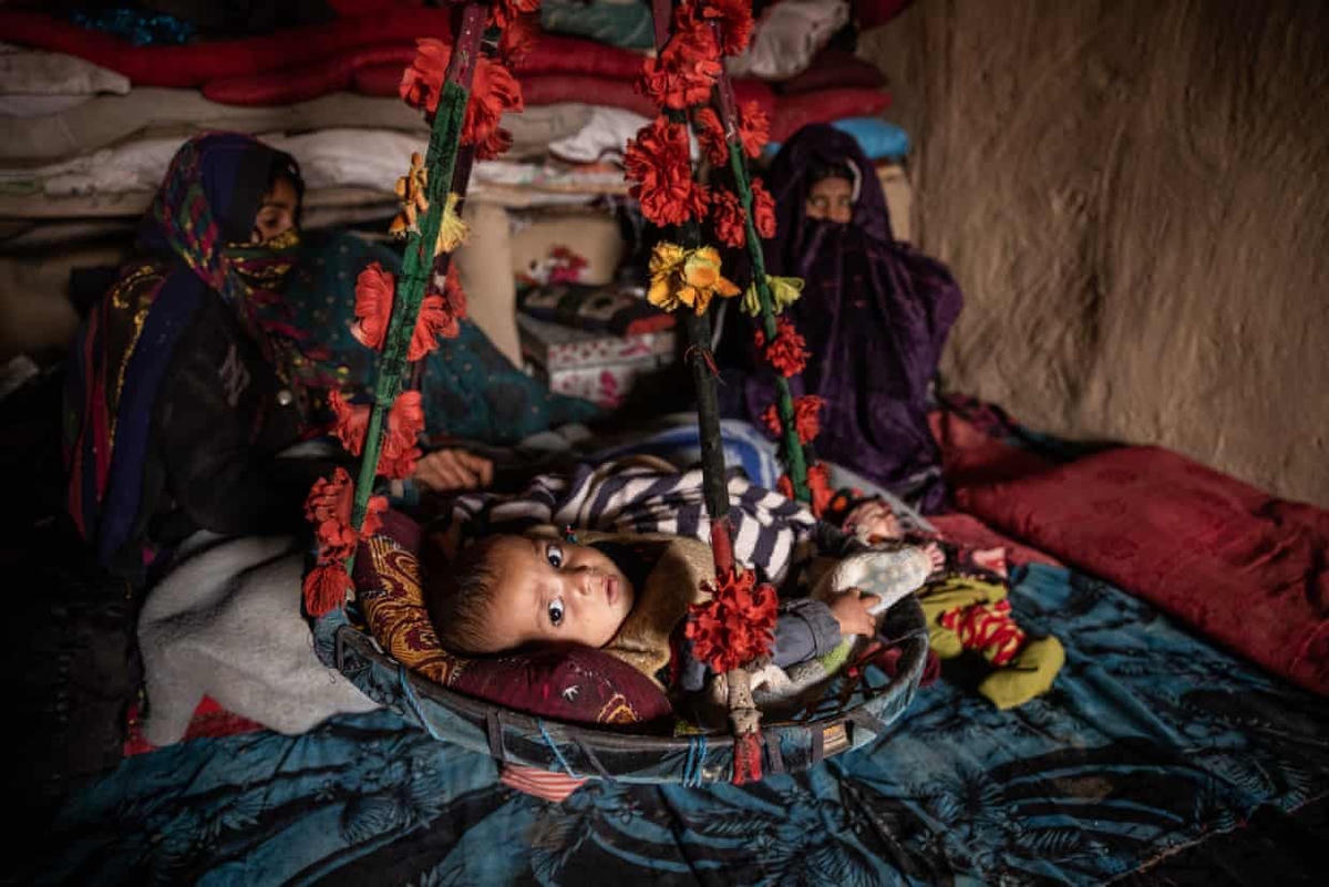 Những đứa trẻ bị suy dinh dưỡng nặng và đang được điều trị bởi nhóm y tế cơ động Save the Children. Ảnh: The Guardian.