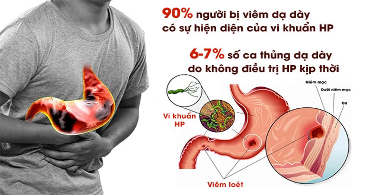 Nguy cơ đến từ vi khuẩn H.P