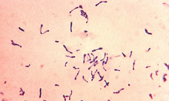 Vi khuẩn Corynebacterium diphtheriae gây ra bệnh bạch hầu. Ảnh:CDC.