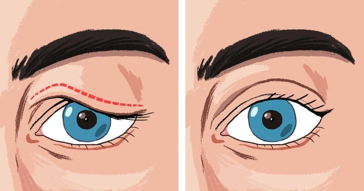 7 mẹo để loại bỏ bọng mắt và quầng thâm