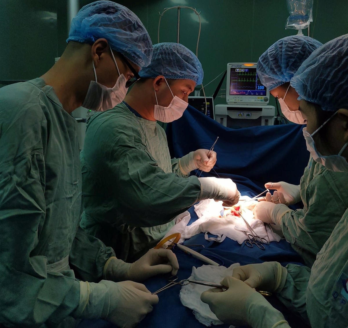 Bác sĩ đang phẫu thuật lấy túi tóc trong dạ dày cháu bé.