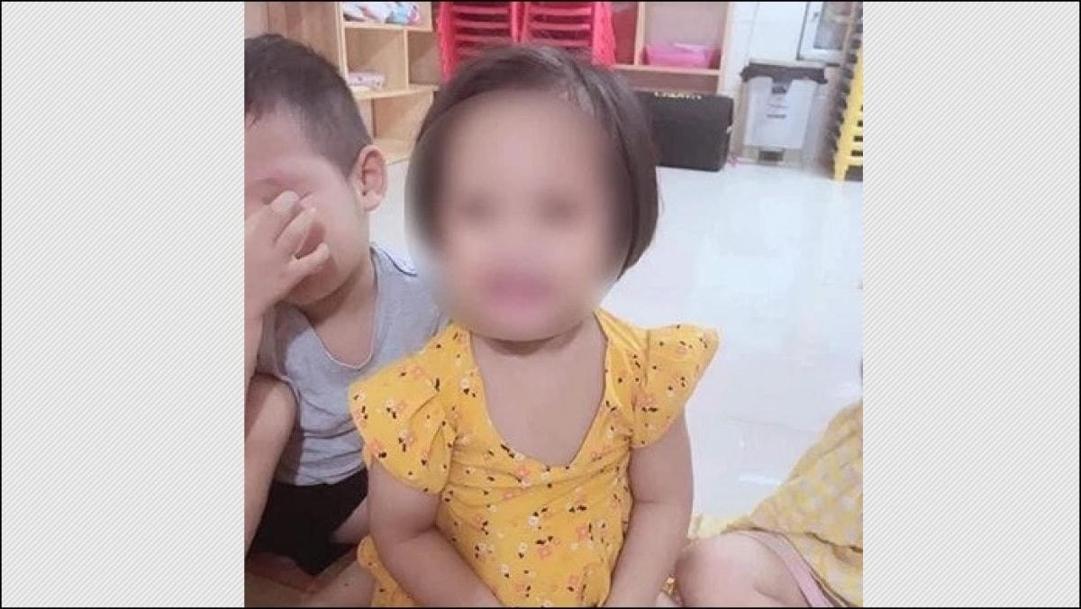 Hình ảnh bé A. trước khi nhập viện.