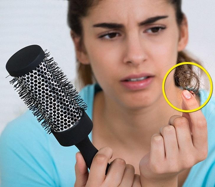 [ẢNH] Rối loạn nội tiết tố 'phá' ngoại hình của bạn như thế nào?