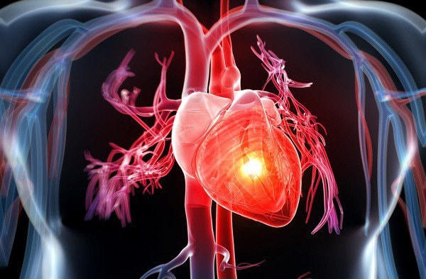 Những dấu hiệu cảnh báo nguy hiểm bệnh lý tim mạch