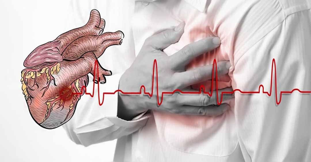 Cảnh báo nguy cơ&nbsp; suy tim, tai biến, đột quỵ