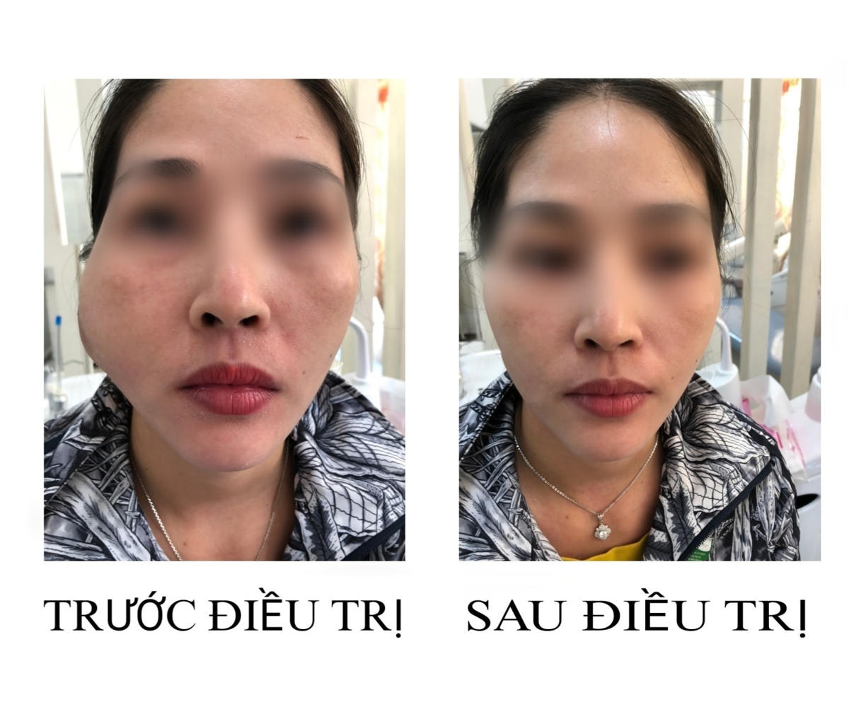 Bệnh nhân trước và sau điều trị.