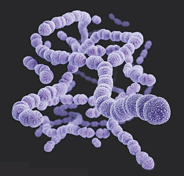 Streptococcus pneumoniae - phế cầu khuẩn thường gây viêm phổi.