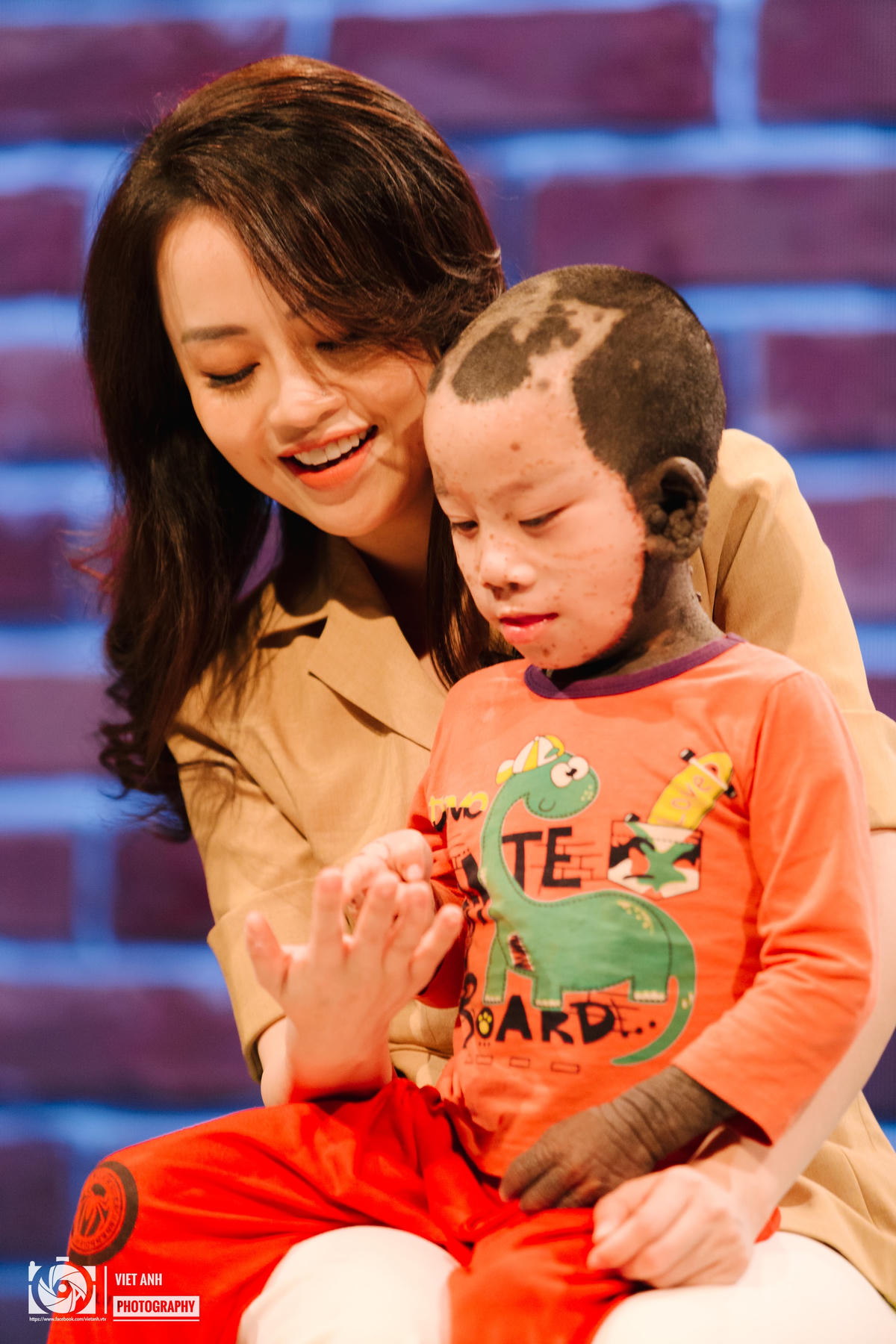 Điều anh Thắng lo lắng nhất là khi bé Đà lớn lên sẽ cảm thấy tự ti về bản thân. 