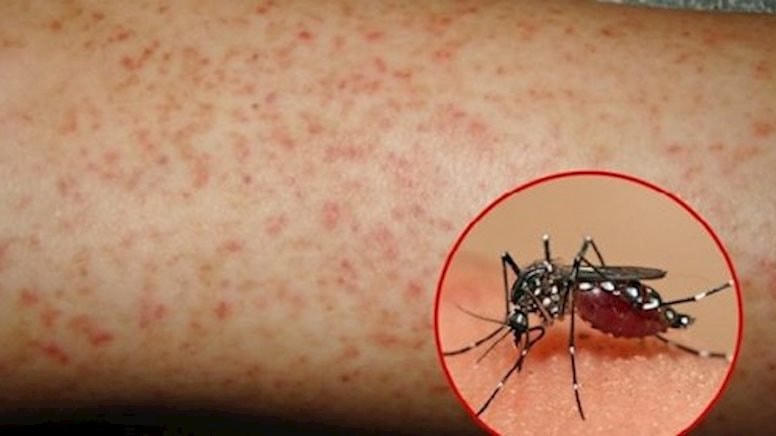 Muỗi vằn Aedes.