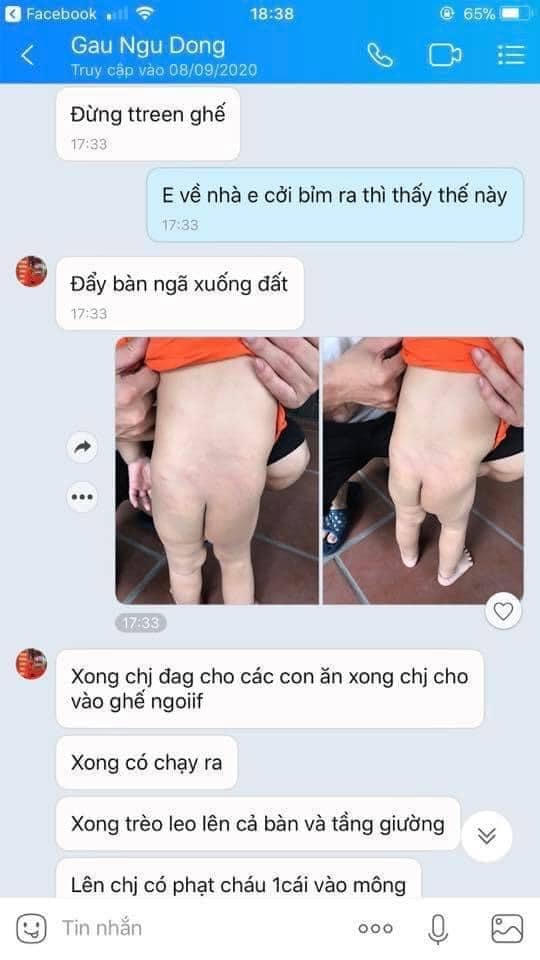 Tin nhắn chị Ngọc trao đổi với cơ sở mầm non khi phát hiện vết thương của cháu bé.