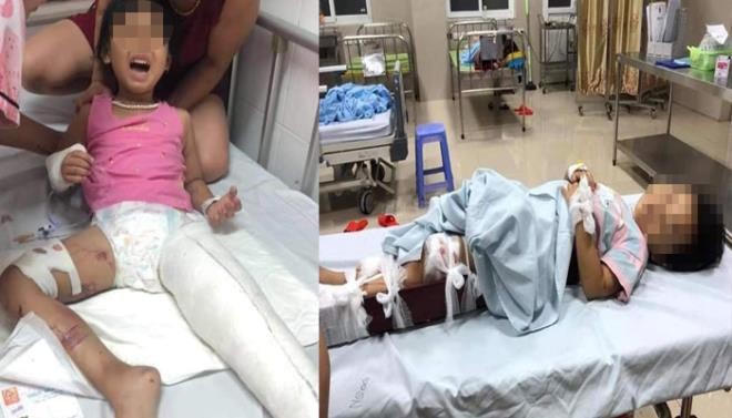 Cháu bé 5 tuổi đau đớn khi bị gãy chân sau tai nạn do tài xế đi ngược chiều gây ra. (Ảnh: Gia đình cung cấp).