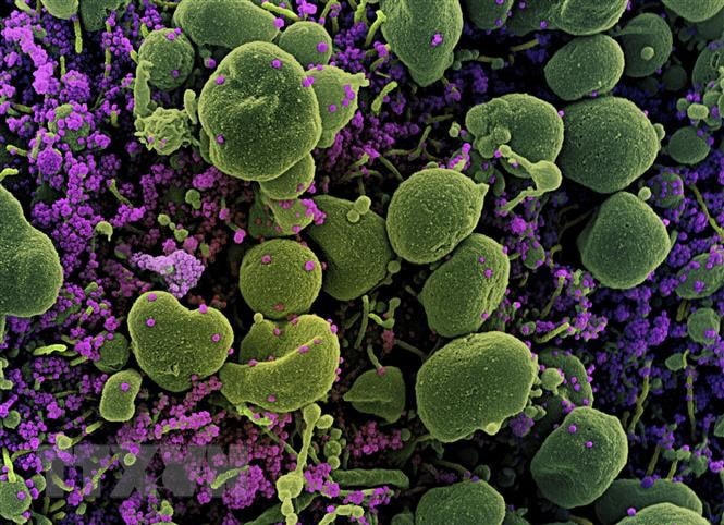 Virus SARS-CoV-2 (màu tím) trong tế bào (màu xanh) của bệnh nhân Covid-19. (Ảnh: AFP/TTXVN).