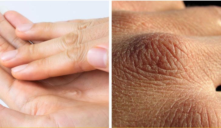 Những vấn đề bạn có thể gặp phải trong mùa đông
