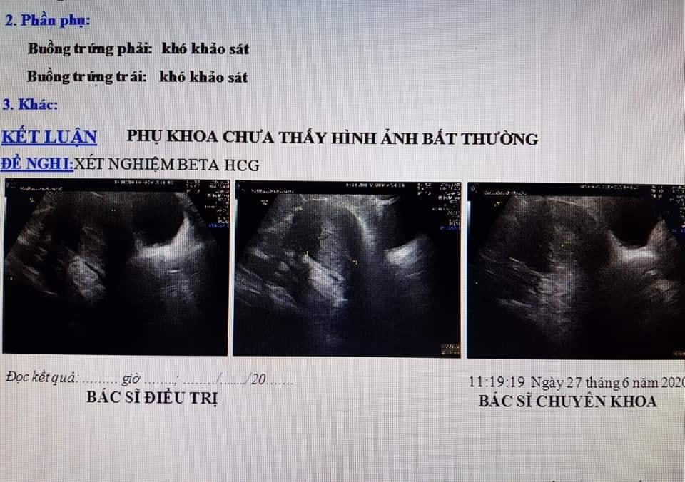 Kết quả siêu âm, xét nghiệm tại Bệnh viện Vĩnh Đức khẳng định chị D. không có thai.