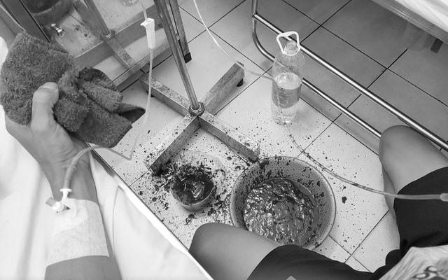 Bệnh lao phổi khiến bệnh nhân bị vỡ động mạch phế quản 