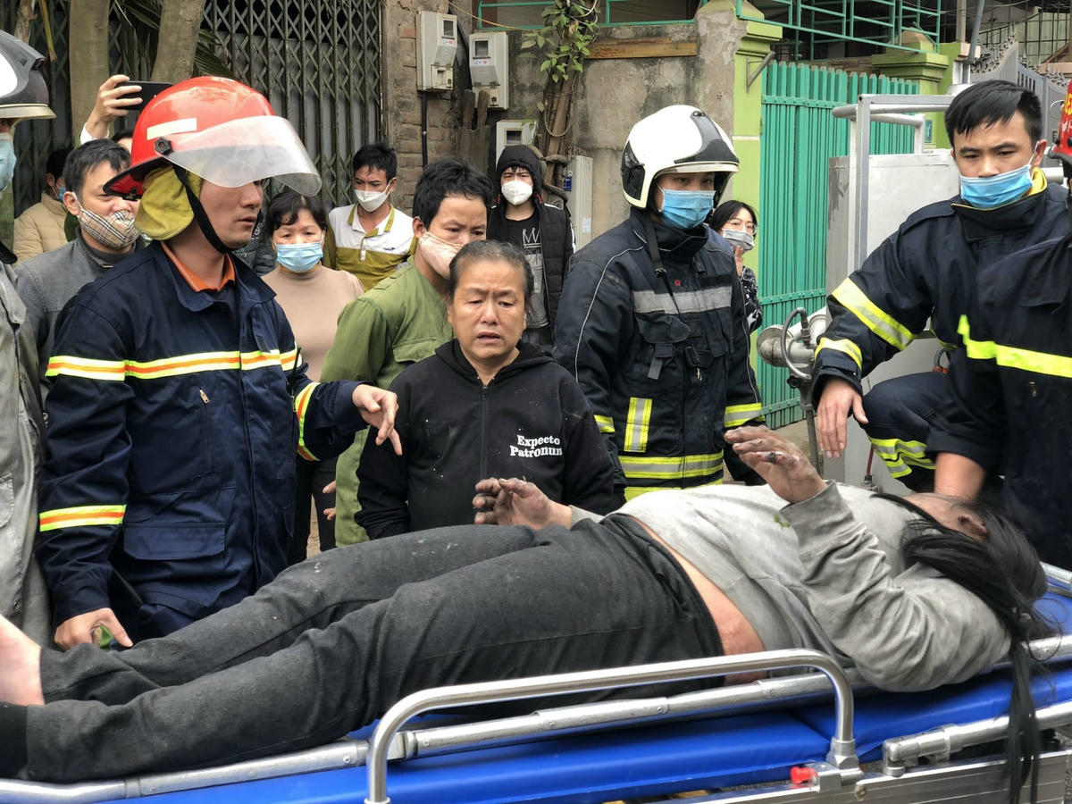 Bé gái bị thương trong vụ cháy (ảnh công an cung cấp).
