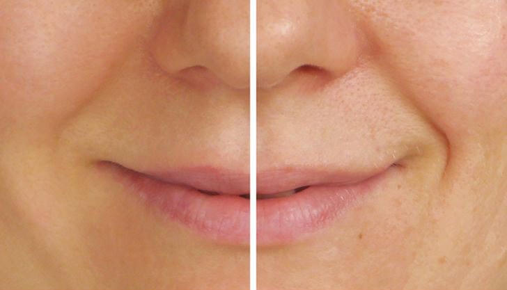 Những vấn đề bạn có thể gặp phải trong mùa đông