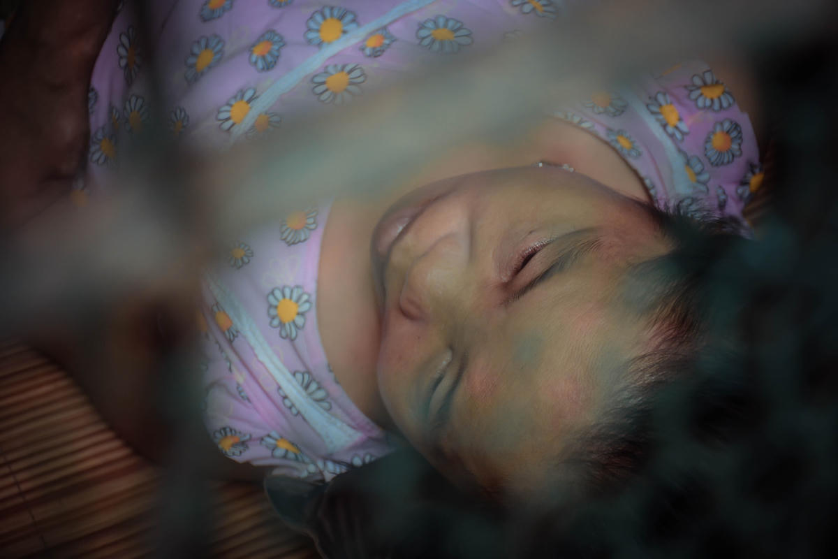 Vài tháng trước đạp xe đi chạy thận đến gần cổng Bệnh viện Đa khoa Nông nghiệp do chóng mặt, bị ngã gãy xương đùi, hiện nay phải sử dụng xe lăn và sự trợ giúp của gia đình và hàng xóm.