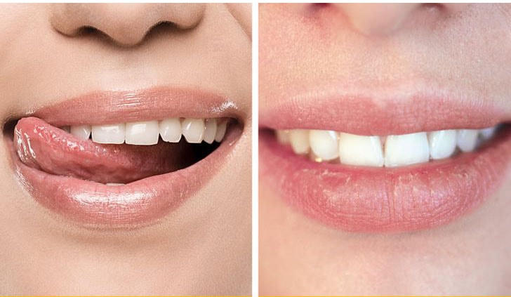 Những vấn đề bạn có thể gặp phải trong mùa đông