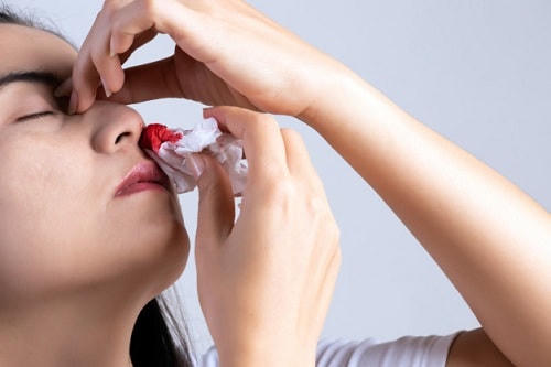 Hay chay máu mũi, vết thương lâu lành có thể bạn thiếu vitamin K.
