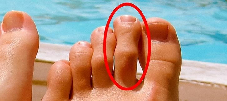 8 dấu hiệu cho thấy cơ thể bạn đang kêu cứu