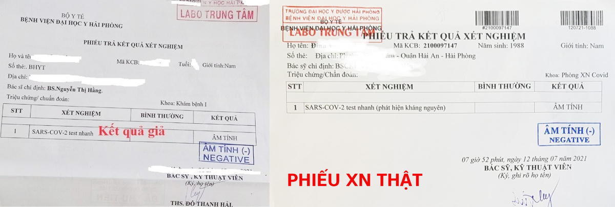 Phiếu XN giả và thật của BVĐH Y Hải Phòng.