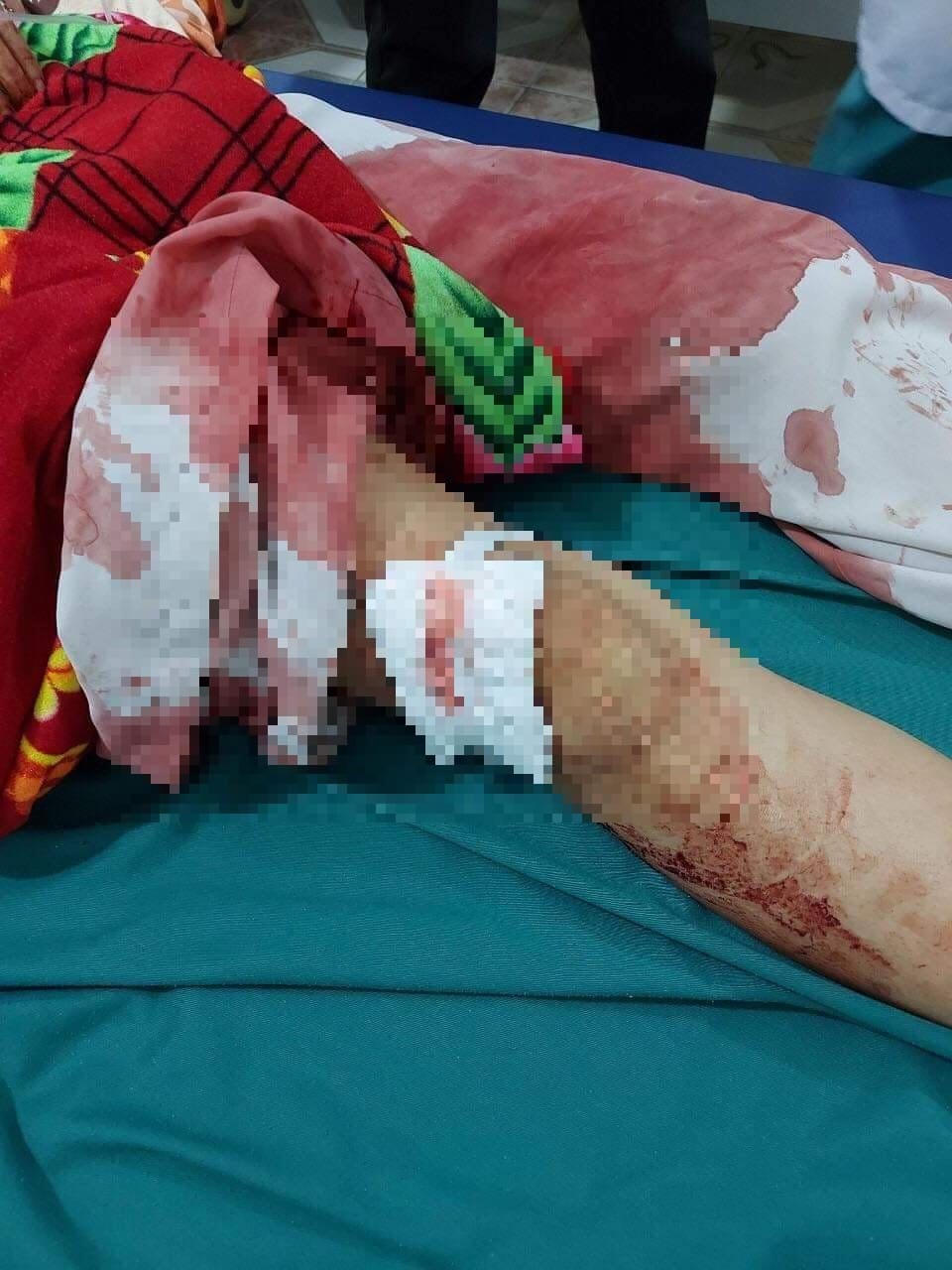 Hiện, cả 2 mẹ con chị Đ. đang được điều trị tại Bệnh viện Đa khoa Nghệ An.
