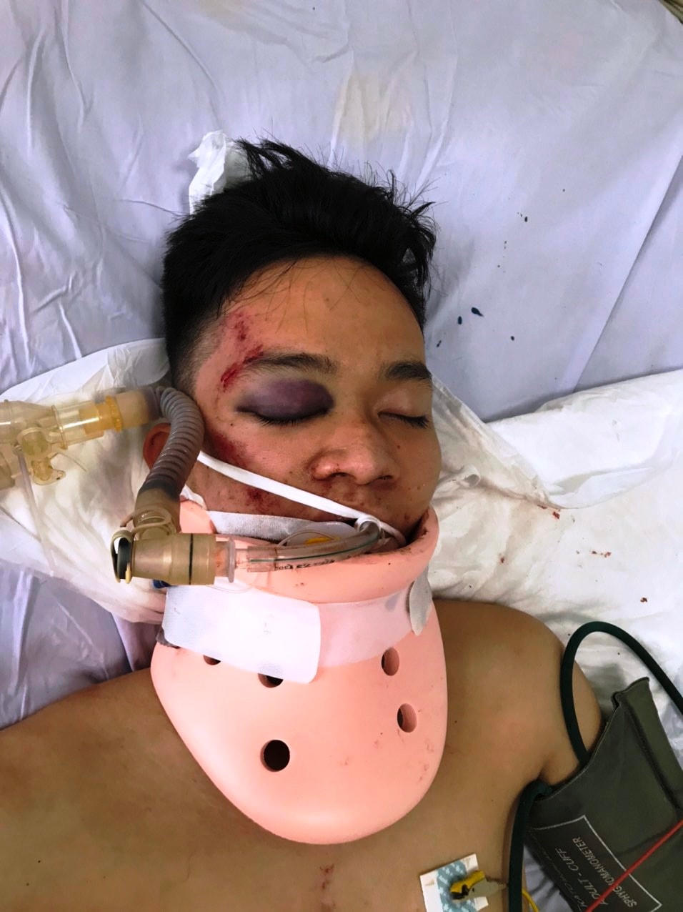 Nguyễn Văn Kiệt đang được điều trị tại bệnh viện.