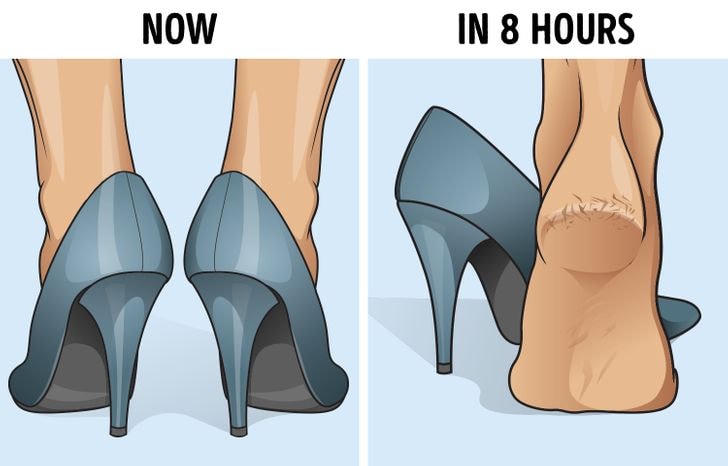 Điểm danh 6 nguyên nhân gây nứt gót chân và cách khắc phục đơn giản