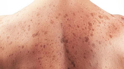 Những rủi ro sức khỏe lớn nhất đối với nam giới