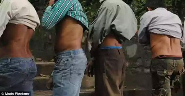 Bốn người đàn ông vạch ra vết sẹo mổ sau khi bán thận. Ảnh: CNN.