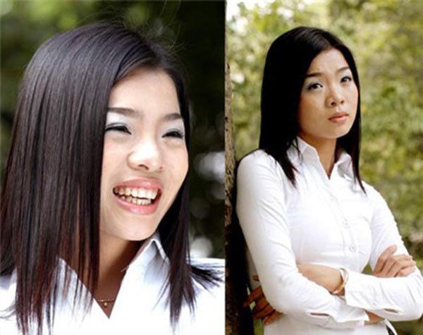 Khi còn tuổi đôi mươi, Lệ Quyên chỉ mới vào nghề và nhan sắc của cô lúc này không có gì nổi bật. Gương mặt tròn bầu bĩnh, da ngăm đen, đường nét nhạt nhòa nên vài năm sau, nữ ca sĩ quyết định phẫu thuật thẩm mỹ và đây có lẽ là quyết định đúng đắn.
