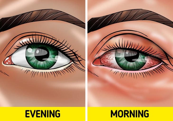 Trang điểm khi ngủ - lợi hay hại?