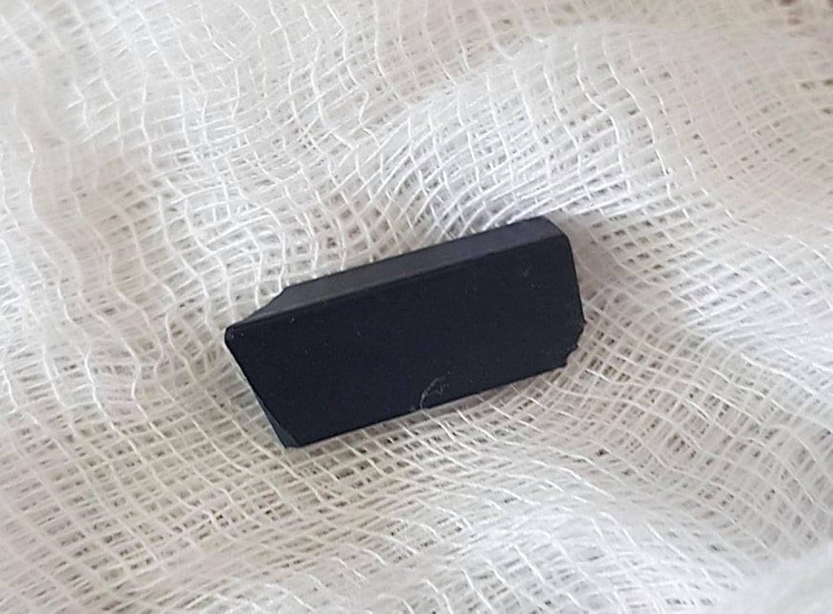 Dị vật là phím bấm điều khiển kích thước 1,5 cm x 1 cm.