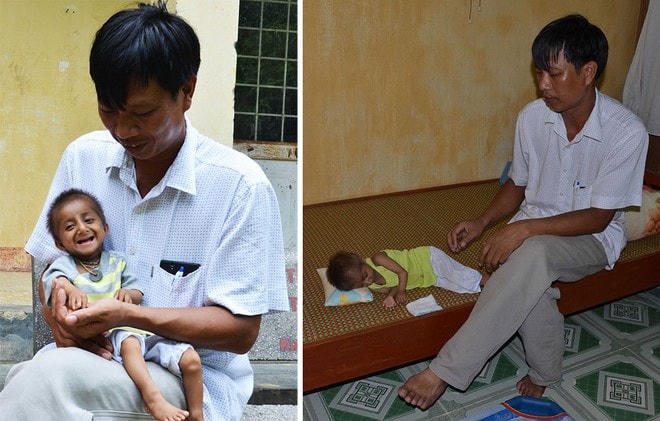 Thầy Cương tận tình chăm sóc cậu bé K’Rể. Nguồn: Thanh niên.